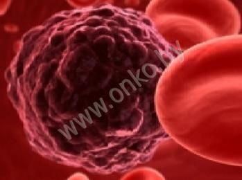 Клетка рака крови под микроскопом